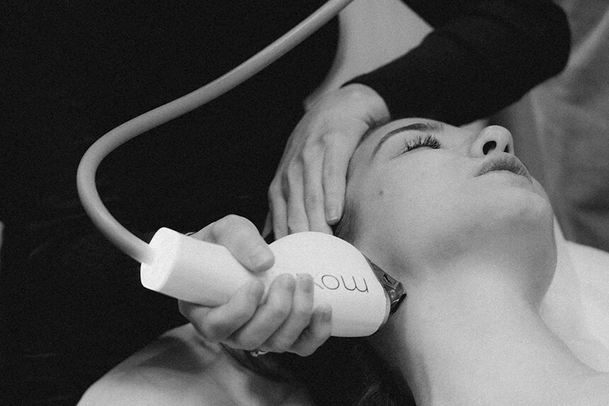 Фракционный лазер Moxi